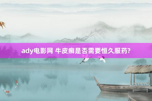 ady电影网 牛皮癣是否需要恒久服药?